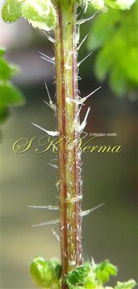  Stem